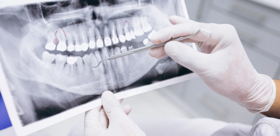 Endodontics